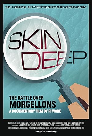 Skin Deep: The Battle Over Morgellons