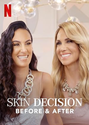 Skin Decision: Before and After